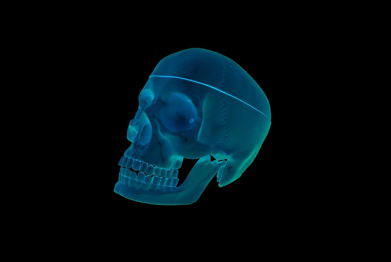 skull, roentgen, the head of the